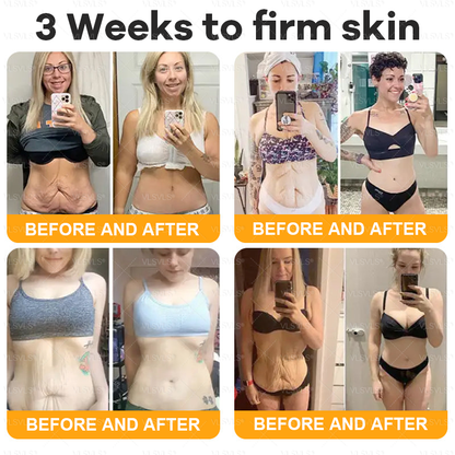 Made and Shipped from USA  ✨  𝑽𝑳𝑺𝑽𝑳𝑺® Bee Venom Comprehensive Cream  LAST DAY 80% OFF(Sagging Skin, Fine Lines, Loss of Firmness, Flat Bust, Drooping Hips, and More)