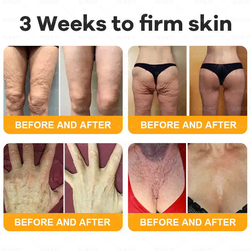 Made and Shipped from USA  ✨  𝑽𝑳𝑺𝑽𝑳𝑺® Bee Venom Comprehensive Cream  LAST DAY 80% OFF(Sagging Skin, Fine Lines, Loss of Firmness, Flat Bust, Drooping Hips, and More)
