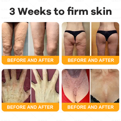 Made and Shipped from USA  ✨  𝑽𝑳𝑺𝑽𝑳𝑺® Bee Venom Comprehensive Cream  LAST DAY 80% OFF(Sagging Skin, Fine Lines, Loss of Firmness, Flat Bust, Drooping Hips, and More)