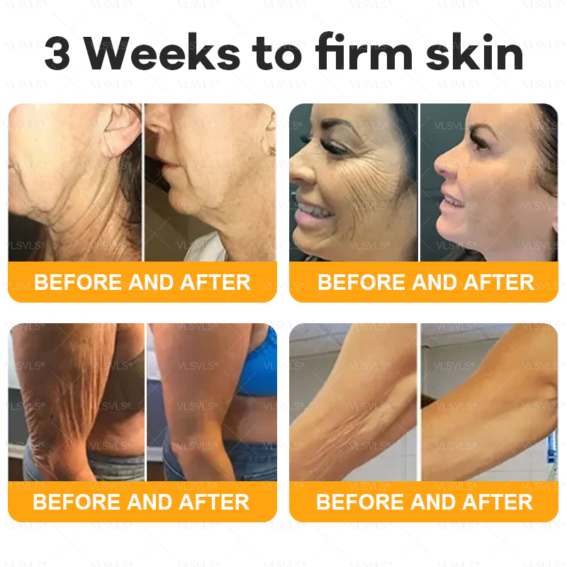 Made and Shipped from USA  ✨  𝑽𝑳𝑺𝑽𝑳𝑺® Bee Venom Comprehensive Cream  LAST DAY 80% OFF(Sagging Skin, Fine Lines, Loss of Firmness, Flat Bust, Drooping Hips, and More)