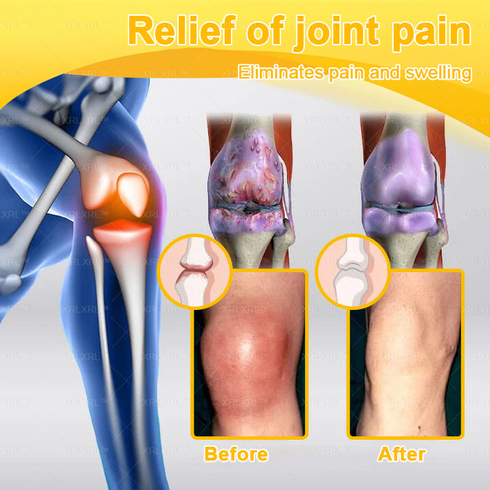 XRLXRL® Bee Venom Pain-Relief Bone Healing Cream (Specially for older adults)☘️